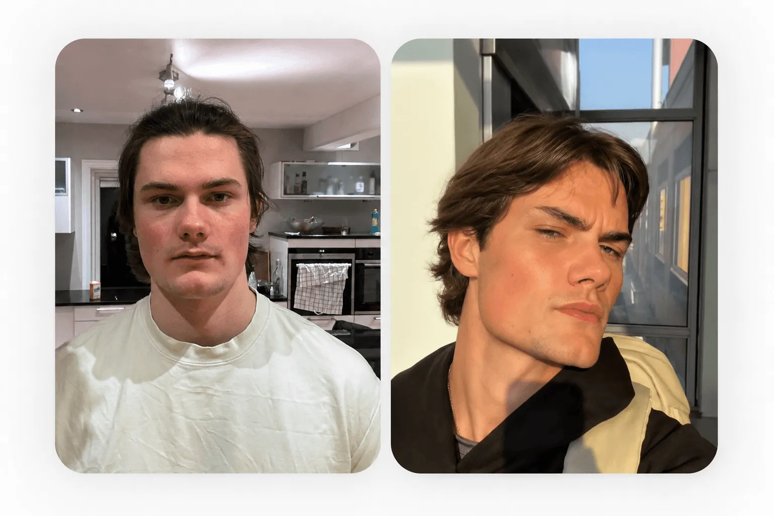 Artur, 21 — Sharper Jawline & Stronger Facial Definition